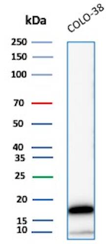 Melan-A/MART-1 Antibody (M2-7C10) Western Blot: Melan-A/MART-1 Antibody (M2-7C10) [NBP2-15197] -