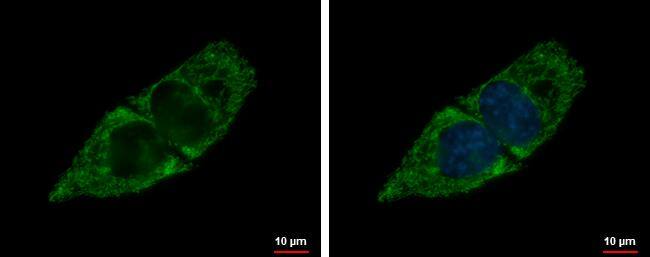ACADSB Antibody - BSA Free