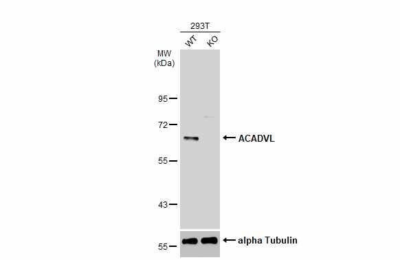 ACADVL Antibody