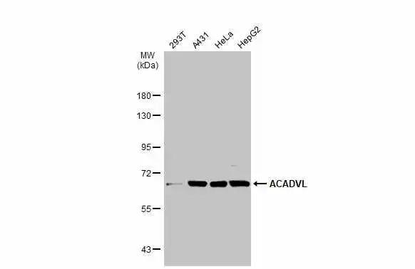 ACADVL Antibody