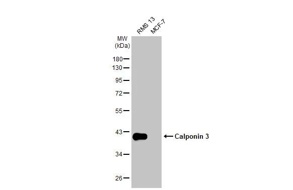 Acidic Calponin Antibody