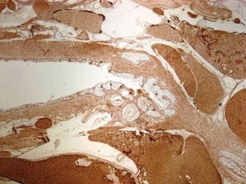 Aconitase 2 Antibody