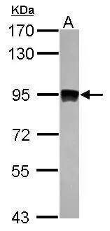 Aconitase 2 Antibody