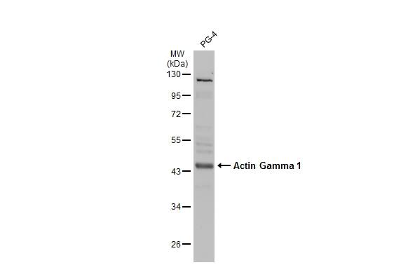 Actin Gamma 1 Antibody