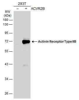 Activin RIIB Antibody