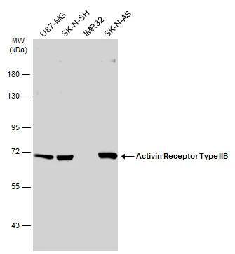 Activin RIIB Antibody