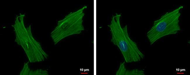 ACTR1B Antibody - BSA Free