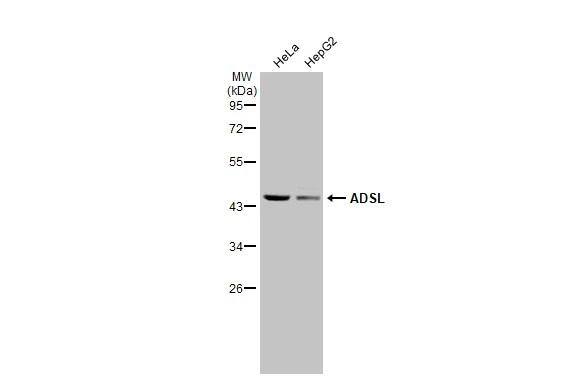 Adenylosuccinate Lyase Antibody - BSA Free