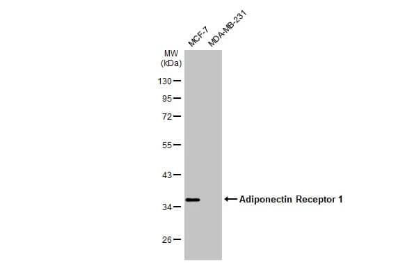 AdipoR1 Antibody