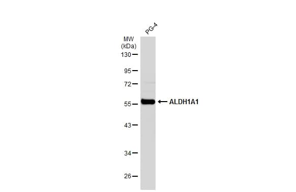 Aldehyde Dehydrogenase 1-A1/ALDH1A1 Antibody