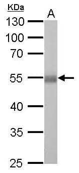Aldehyde Dehydrogenase 1-A1/ALDH1A1 Antibody