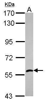 ALDH7A1 Antibody