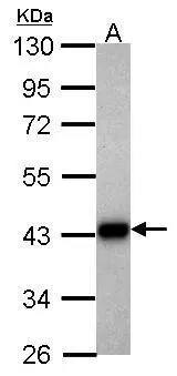 Aldolase B Antibody