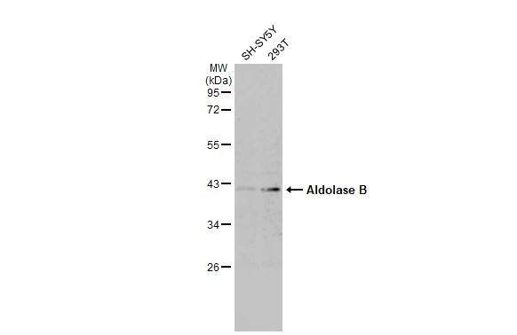 Aldolase B Antibody - BSA Free