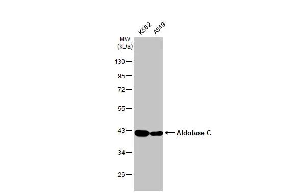 Aldolase C Antibody