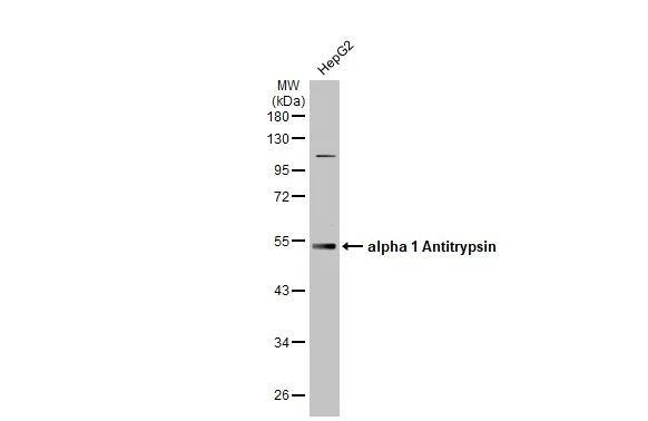 Serpin A1/alpha 1-Antitrypsin Antibody - BSA Free