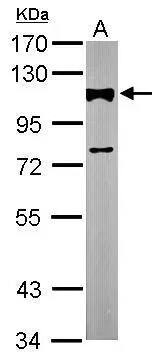 Alpha Actinin 2 Antibody