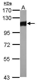 Alpha Actinin 3 Antibody