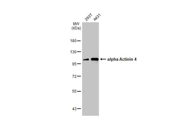 Alpha Actinin 4 Antibody - BSA Free