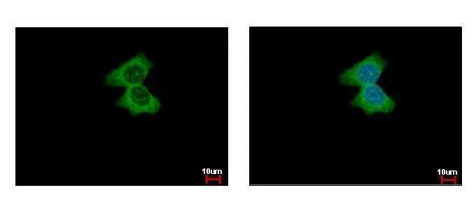 Alpha Actinin 4 Antibody