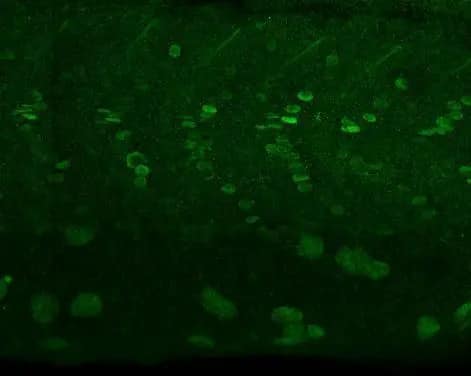alpha Adducin Antibody