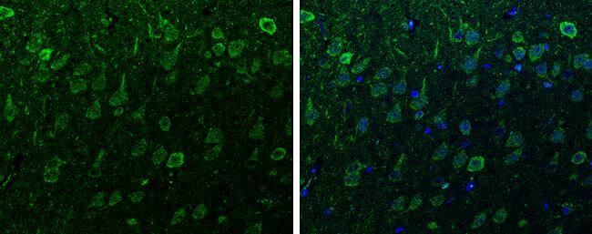 alpha-Synuclein Antibody - Azide Free