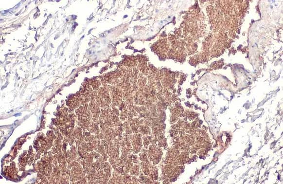 Apolipoprotein A-I/ApoA1 Antibody