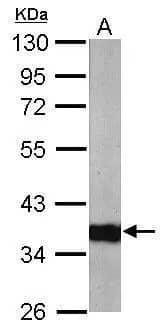 ARPC1A Antibody