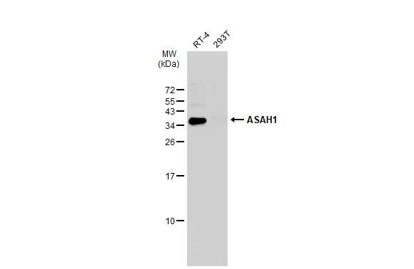 ASAH1 Antibody