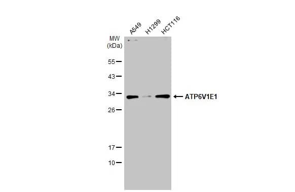 ATP6V1E1 Antibody