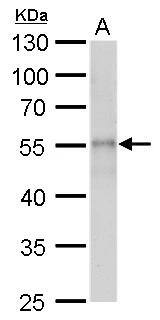beta II Tubulin A Antibody