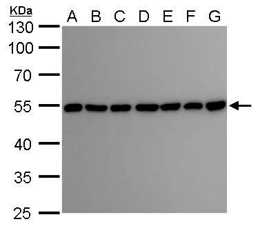 beta II Tubulin A Antibody