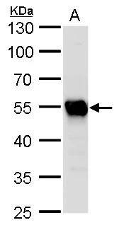 beta II Tubulin A Antibody