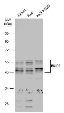 BNIP2 Antibody
