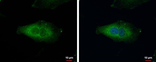 NDUFAF5 Antibody - BSA Free