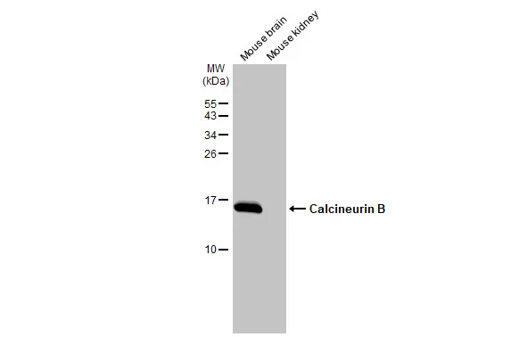 Calcineurin B Antibody