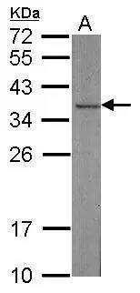 CAPZA2 Antibody