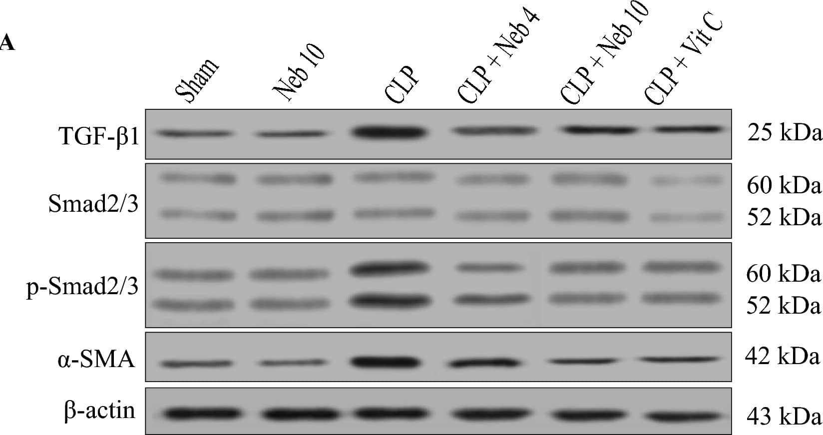 alpha-Smooth Muscle Actin Antibody