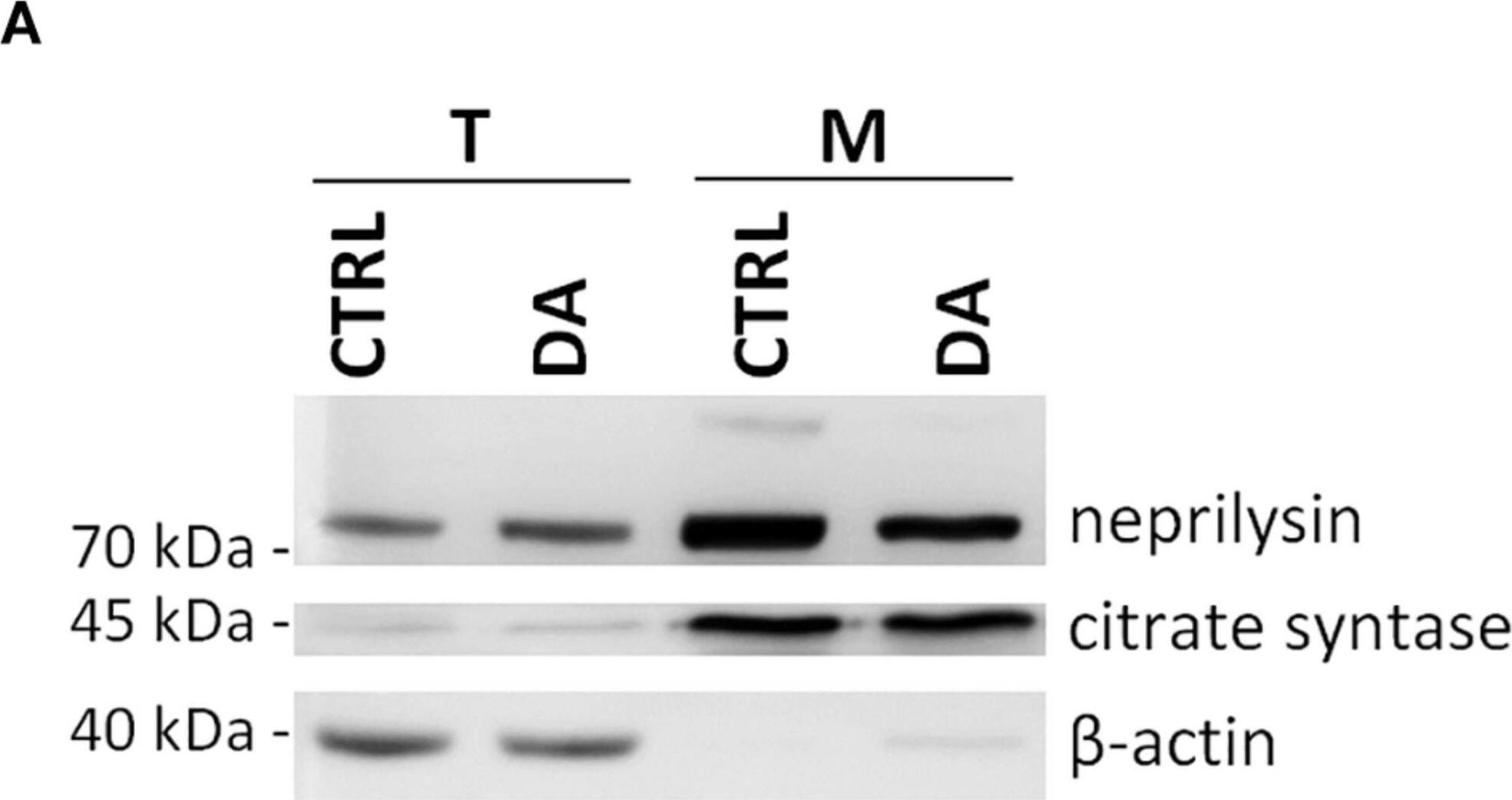 Neprilysin/CD10 Antibody - BSA Free