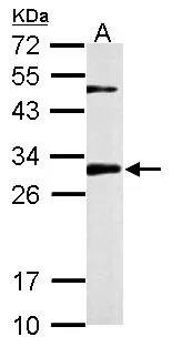 CHMP2B Antibody
