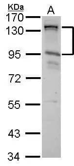 CIZ1 Antibody