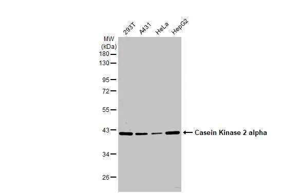 Casein Kinase 2 alpha Antibody