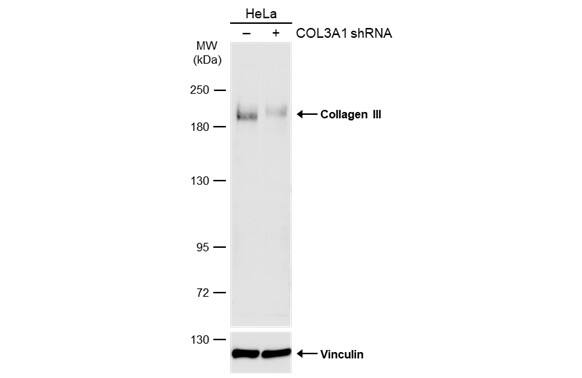 Collagen III alpha 1/COL3A1 Antibody