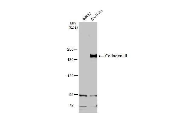 Collagen III alpha 1/COL3A1 Antibody - BSA Free