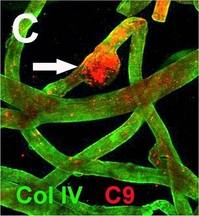 Complement Component C9 Antibody