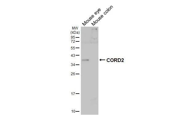 CRX/CORD2 Antibody