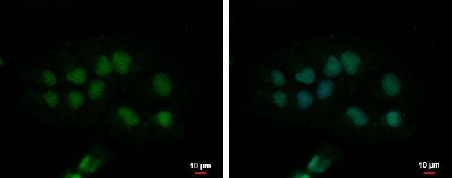 CPSF2 Antibody - BSA Free