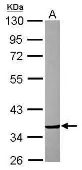 CRYZ Antibody