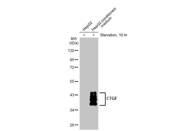 CTGF/CCN2 Antibody