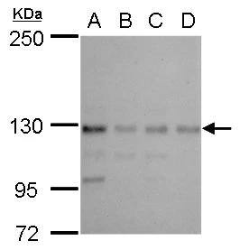 CTR9 Antibody